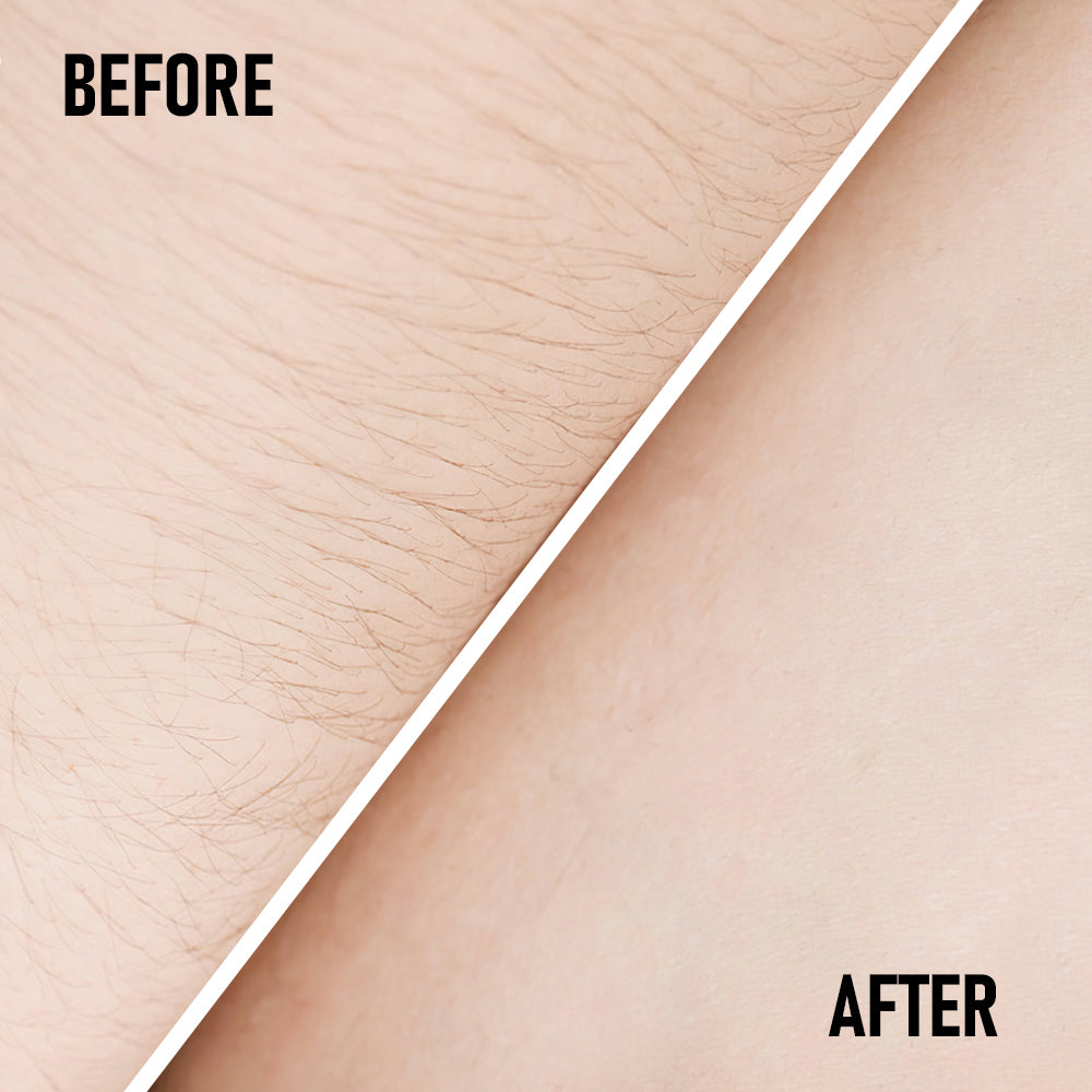 Creme Depilatório Indolor – Remoção de Pelos Rápida